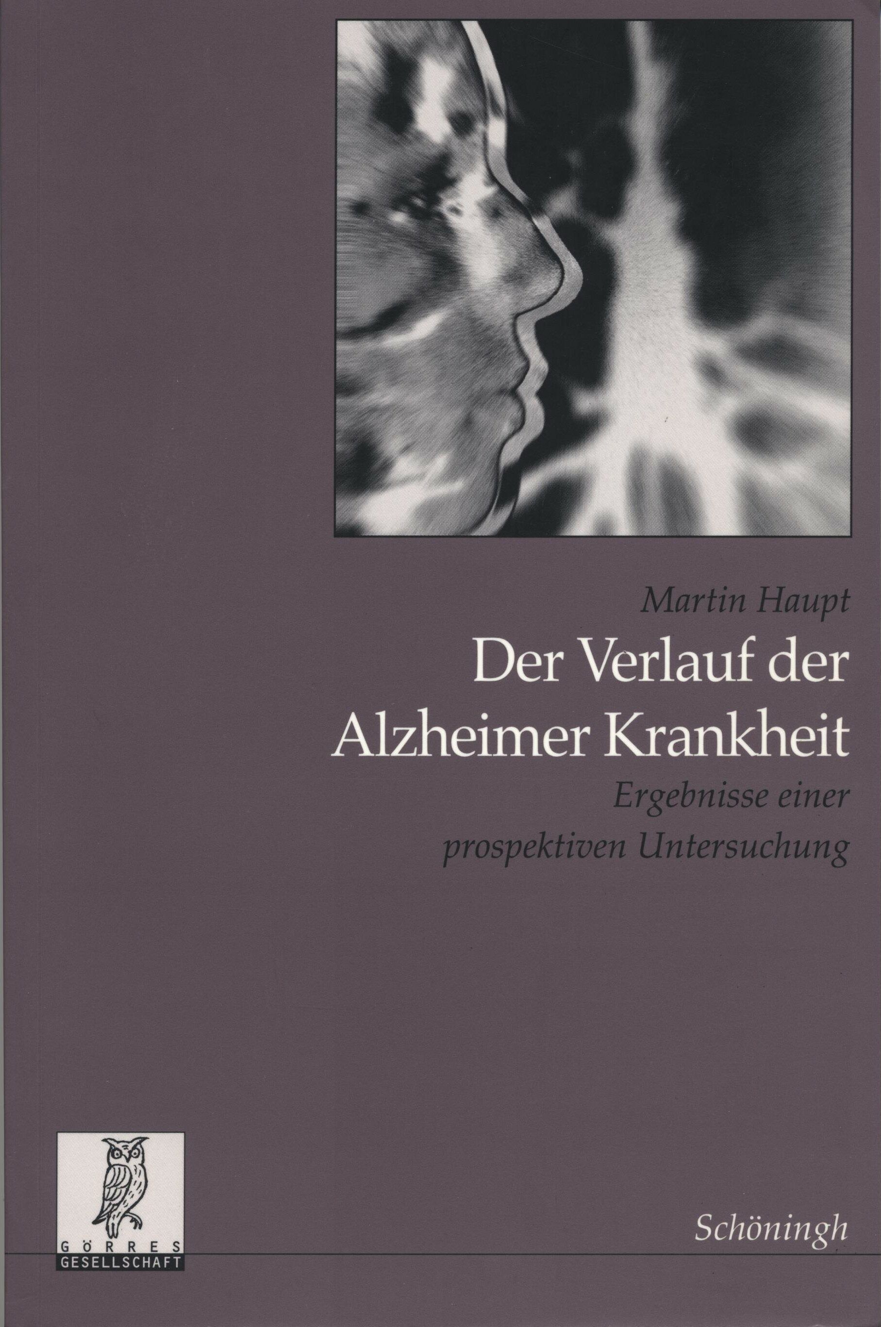 Der Verlauf der Alzheimer Krankheit