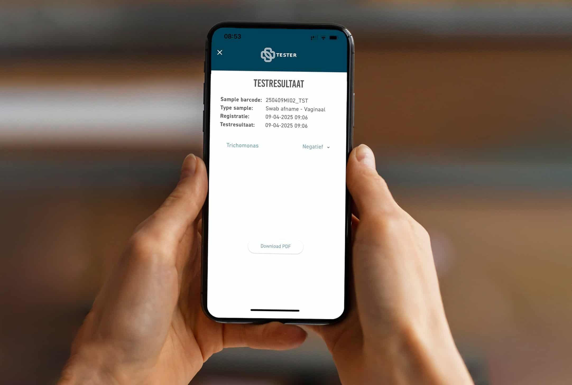 Smartphone zeigt Testergebnis eines Trichomonaden-Tests an.
