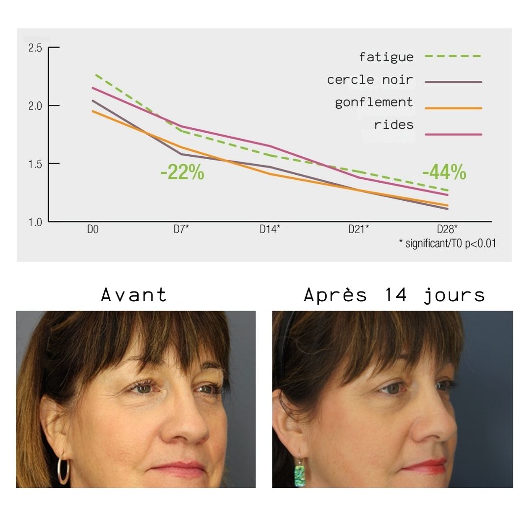 Graphique : amélioration de la fatigue, des cernes, des poches et des rides après 28 jours. Photos avant-après d'une femme.