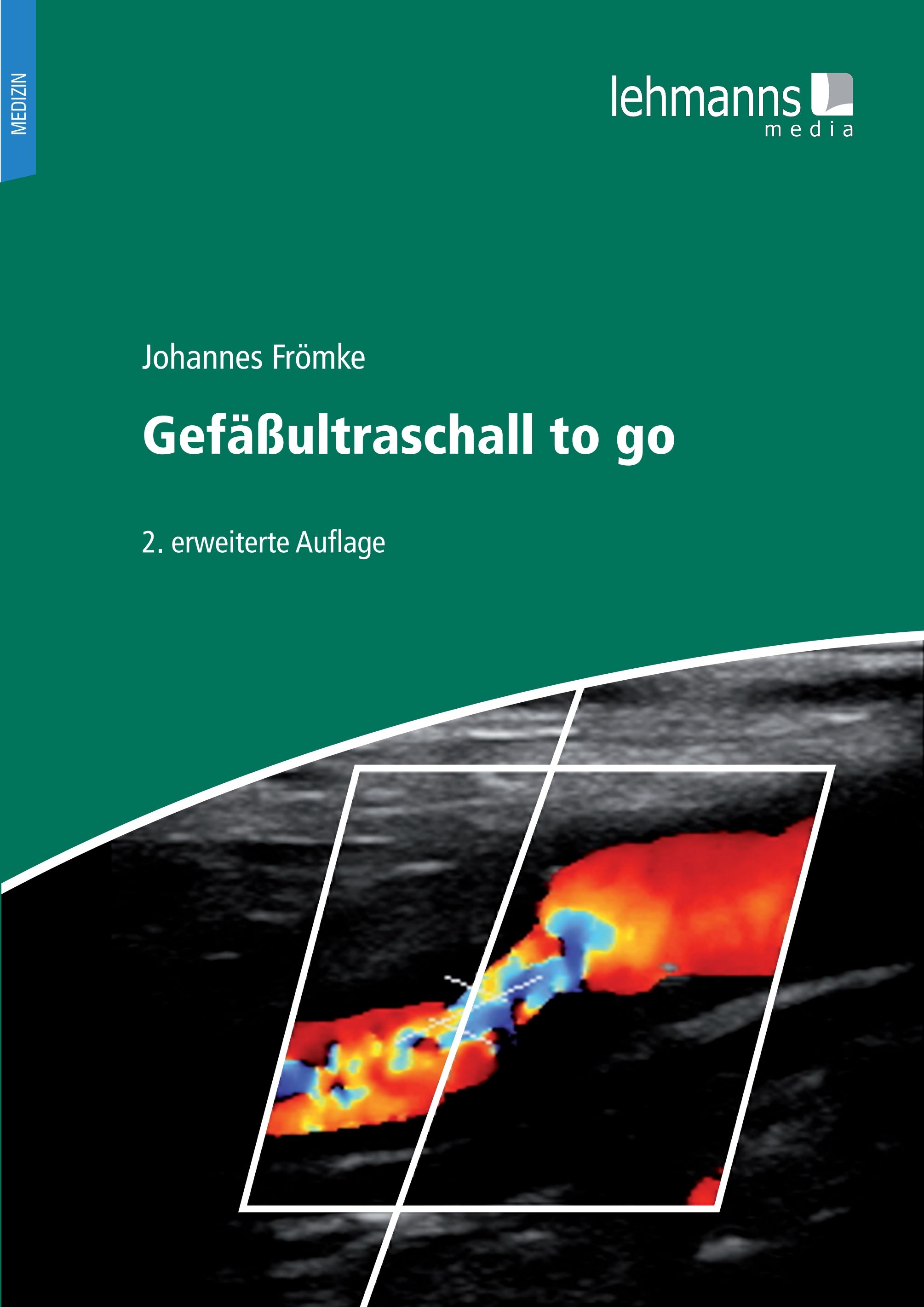 Buchcover mit Titel "Gefäßultraschall to go" von Johannes Frömke. Verlag Lehmanns Media. Abbildung eines Ultraschallbildes.