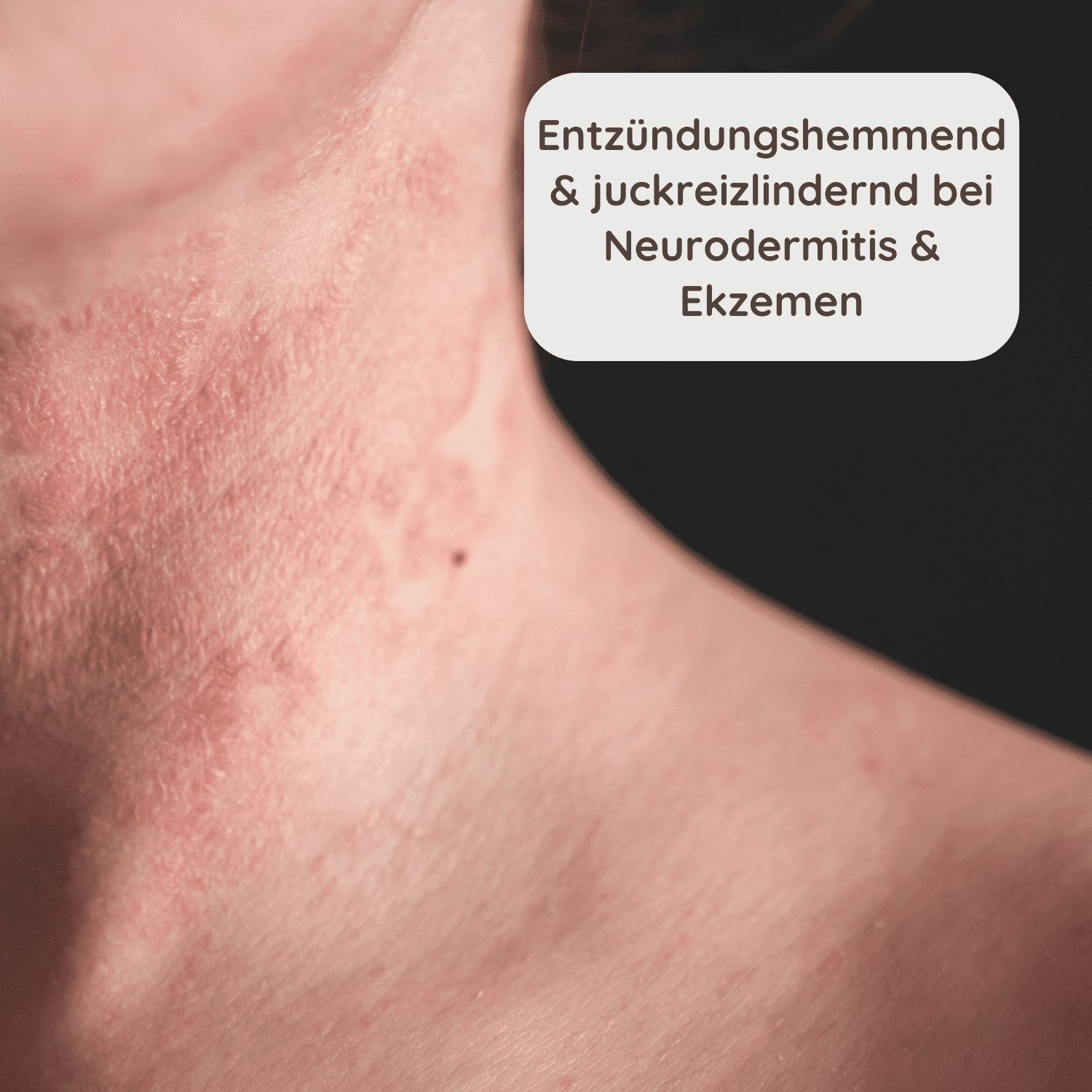 Schlosskräuter Hautschmeichler für Neurodermitis & Ekzeme