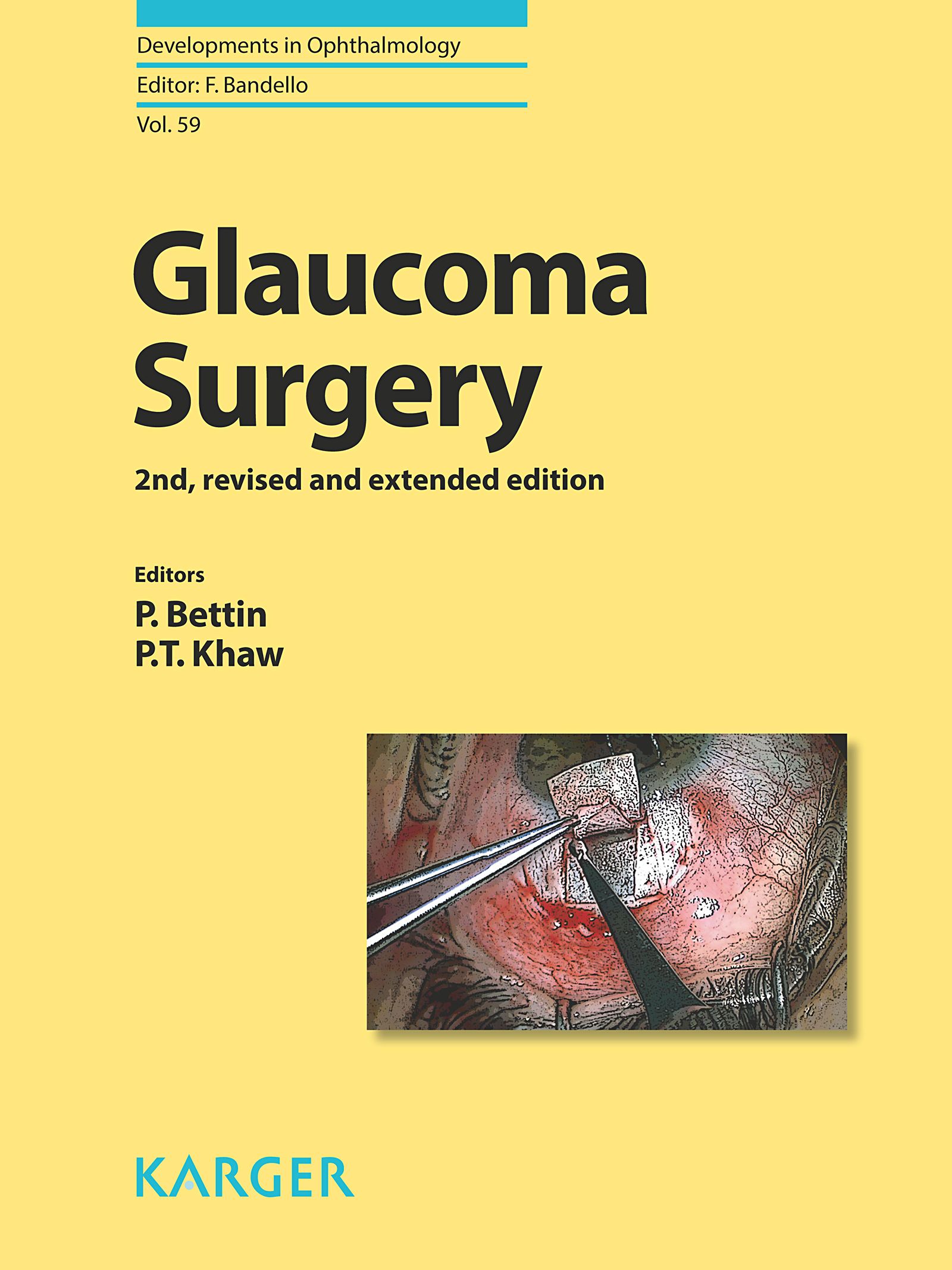 Buchcover: Glaukomchirurgie, 2., überarbeitete und erweiterte Auflage. Herausgeber: P. Bettin, P.T. Khaw. Verlag: Karger.