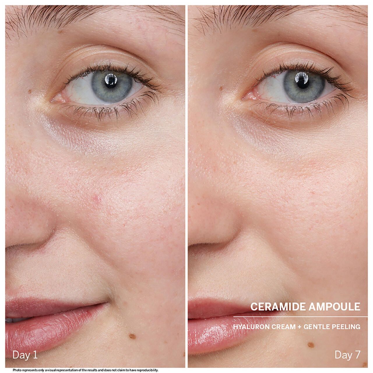 Vorher-Nachher-Bild. Gesichtshälften zeigen Hautveränderungen. Beschriftung: Ceramide Ampulle, Hyaluron Creme + Gentle Peeling.