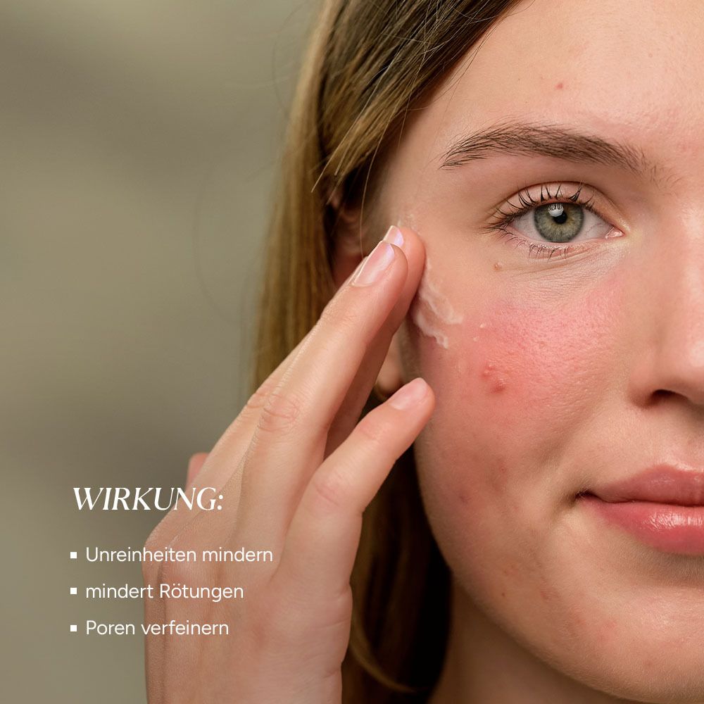 JUNGLÜCK Azelain Serum - gegen Pickel & Rötungen, 10% azelaic acid