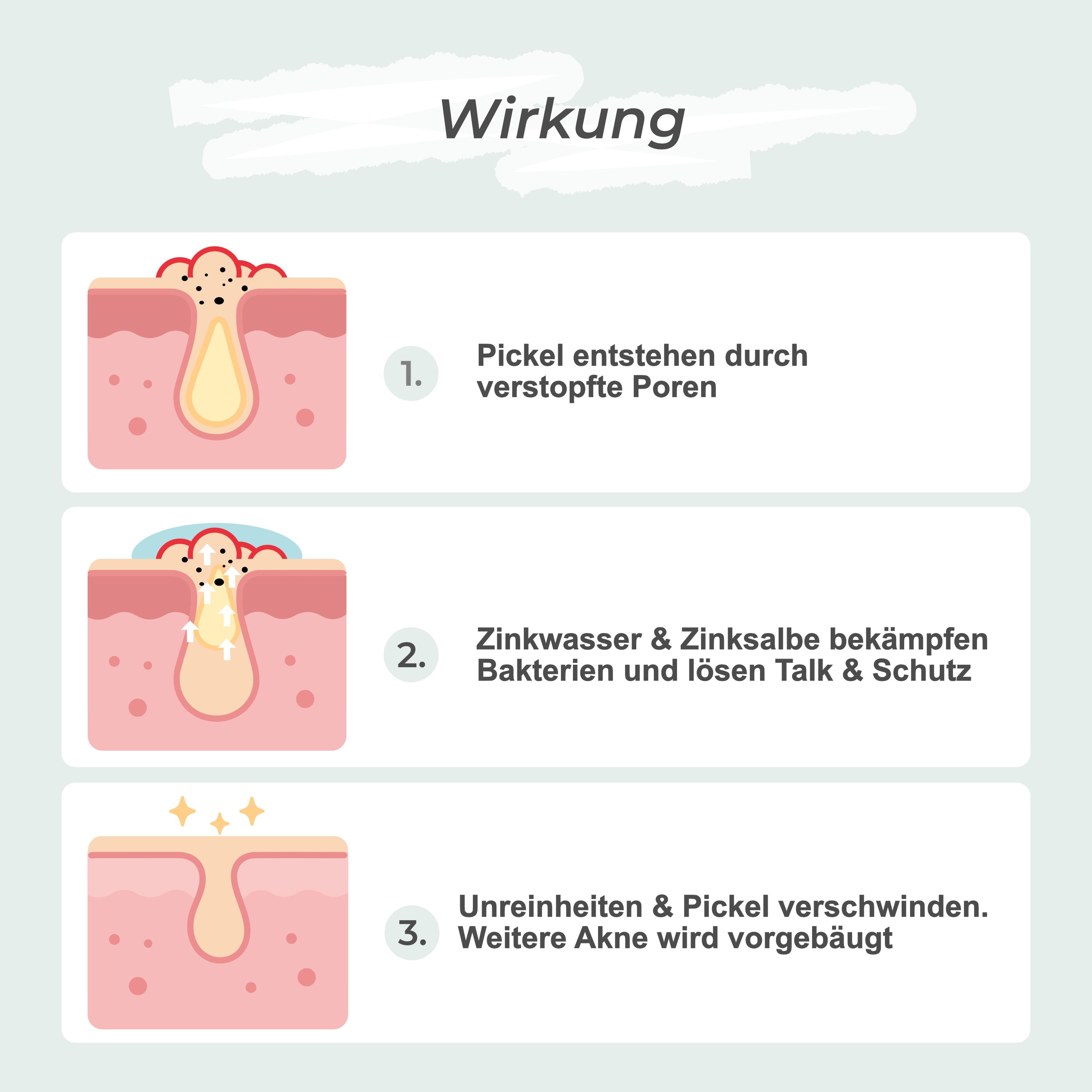 VIGOROUS® Zinkwasser & Zinksalbe gegen Pickel und unreine Haut