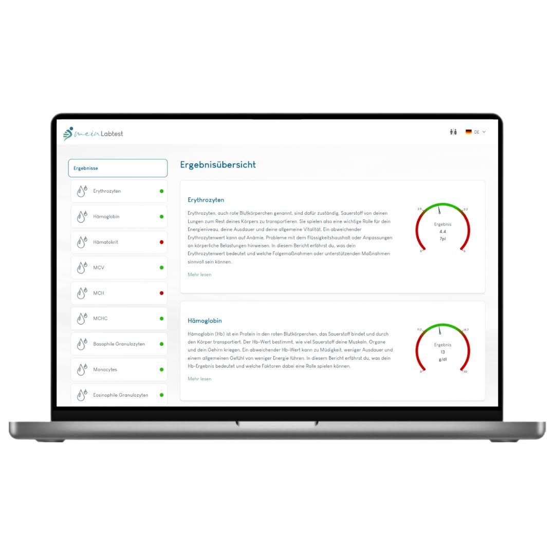Laptop mit Testergebnissen. Auf dem Bildschirm "Ergebnisübersicht". Anzeige von Testergebnissen und Diagrammen.