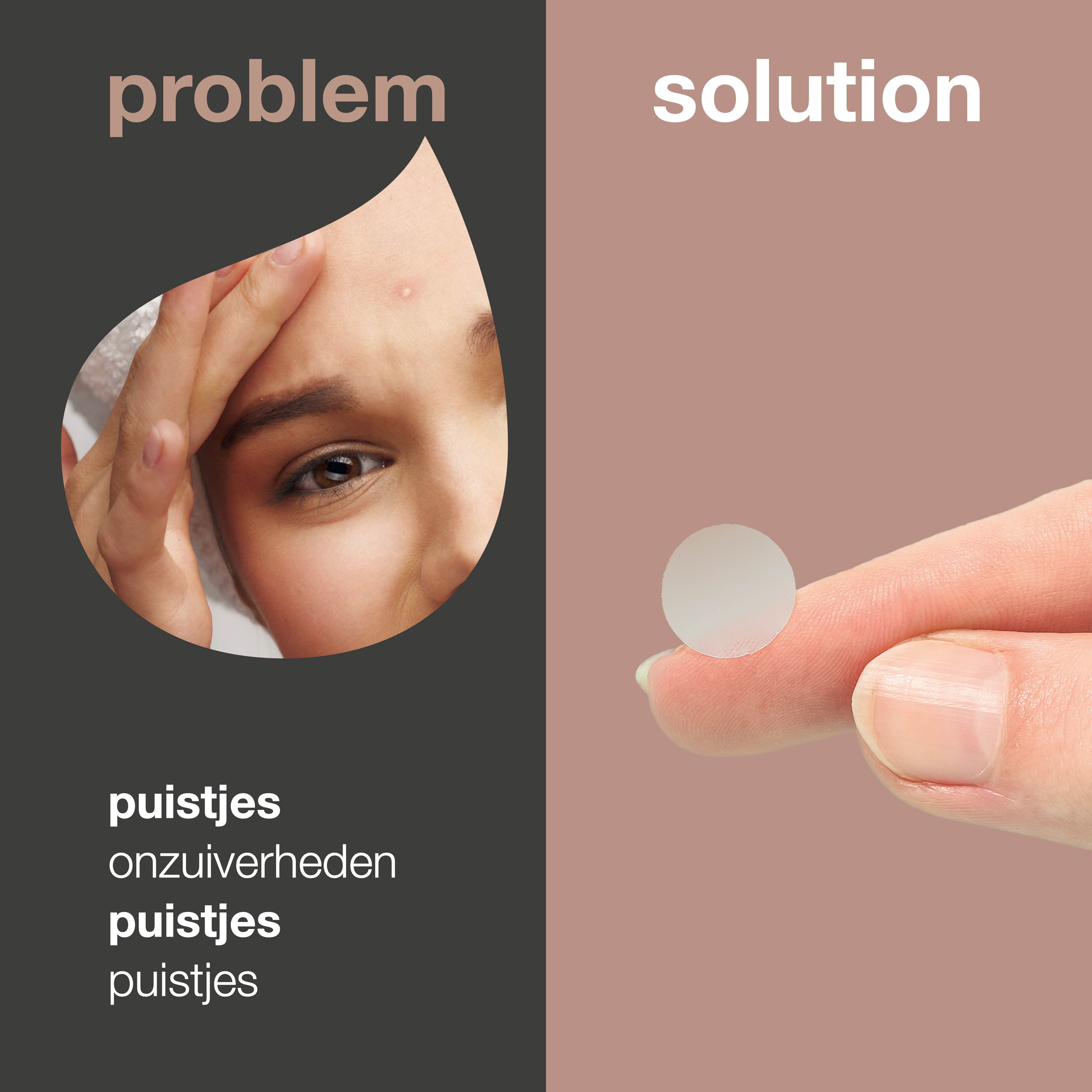 Afbeelding met probleem en oplossing. Gezicht met puistje, vinger met pleister. Tekst: puistjes, onzuiverheden, puistjes.