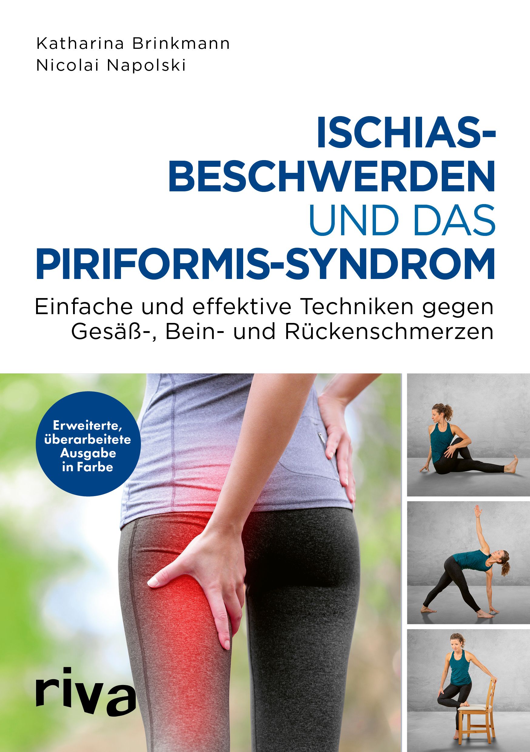 Ischiasbeschwerden und das Piriformissyndrom