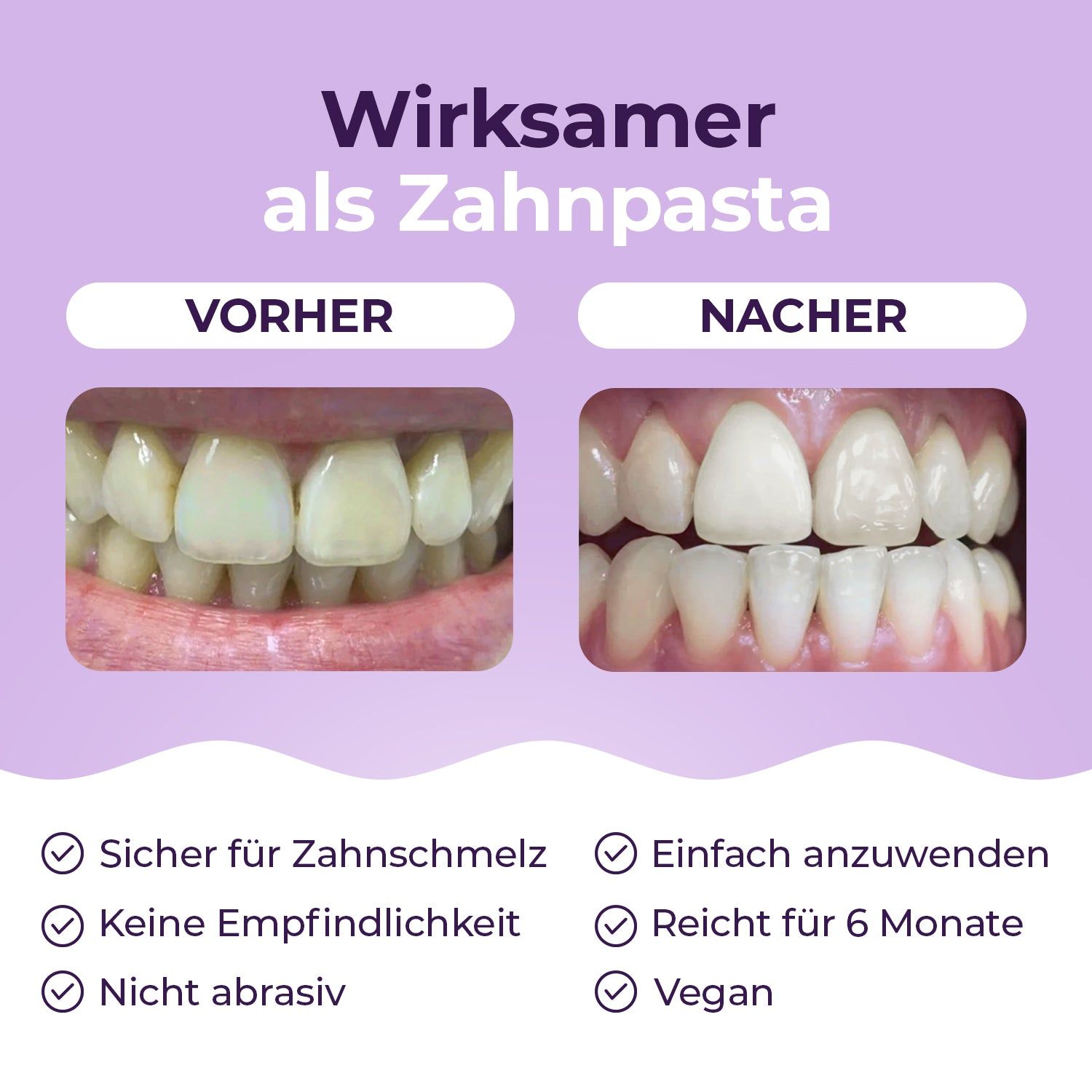 OnlySmile® Zahnaufhellungspulver für Weiße Zähne