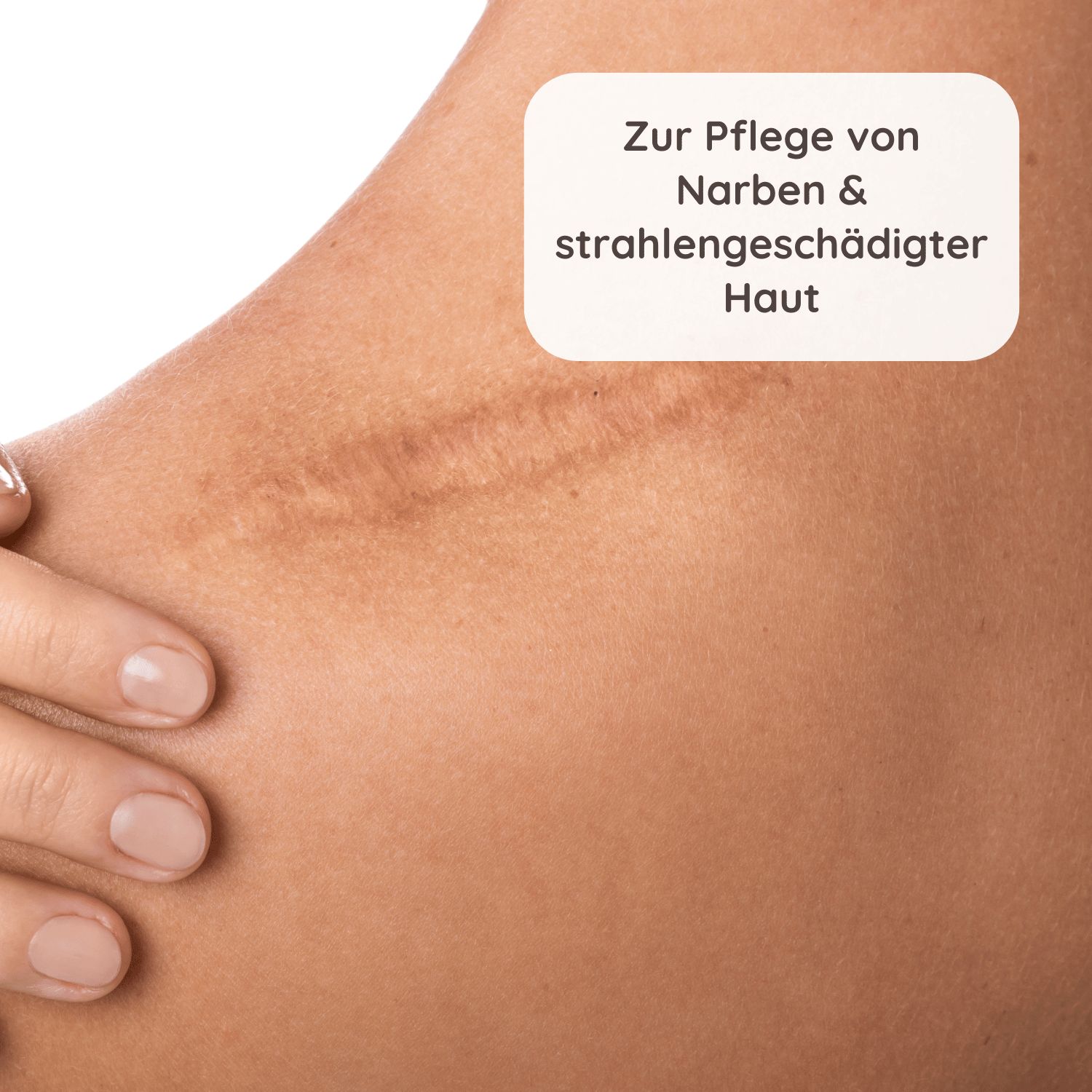 Schlosskräuter Narbenschmeichler Narbenöl & Körperöl