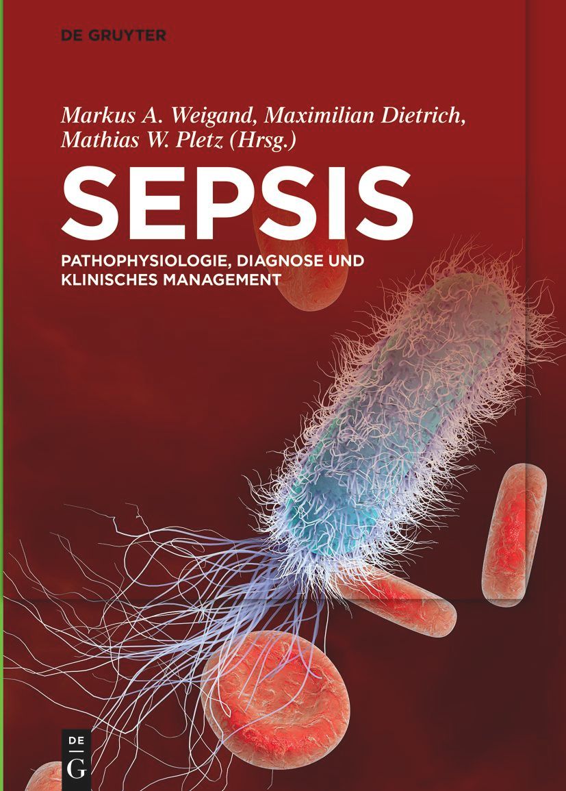 Buchcover mit Titel SEPSIS. Autorennamen und Untertitel: Pathophysiologie, Diagnose und klinisches Management. Abbildung von Bakterien und Blutzellen.