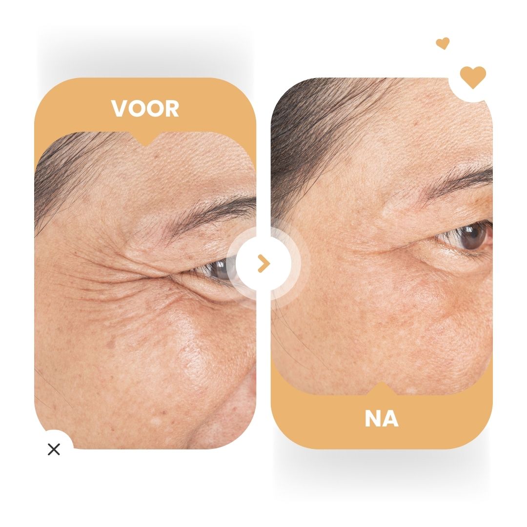 Voor-en-na-afbeelding. Gezicht met rimpels, dan gladdere huid. Dagcrème-effect.