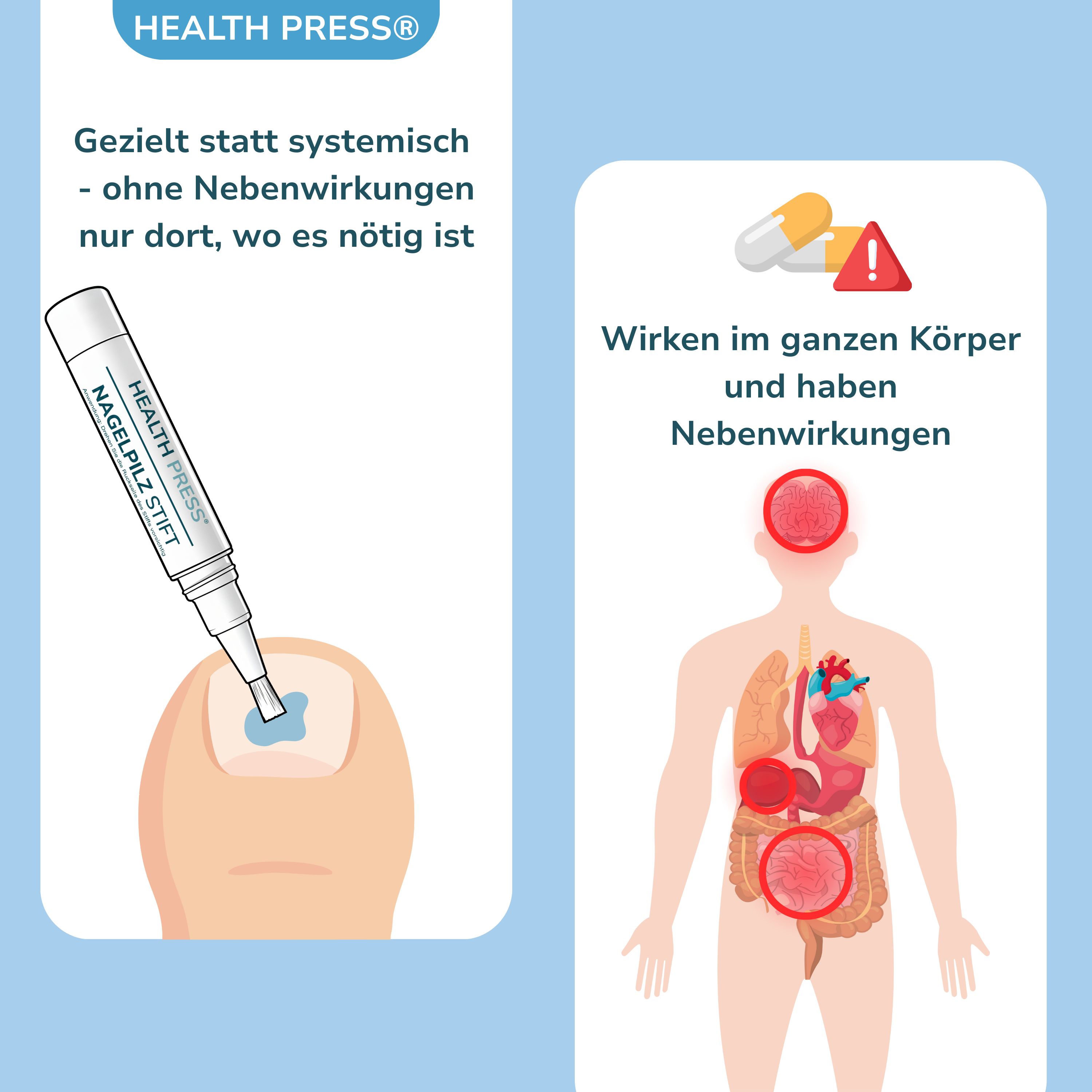 Stift auf Zehennagel. Vergleich: systemische Wirkung vs. lokale Anwendung. Health Press Nagelpilz Stift.