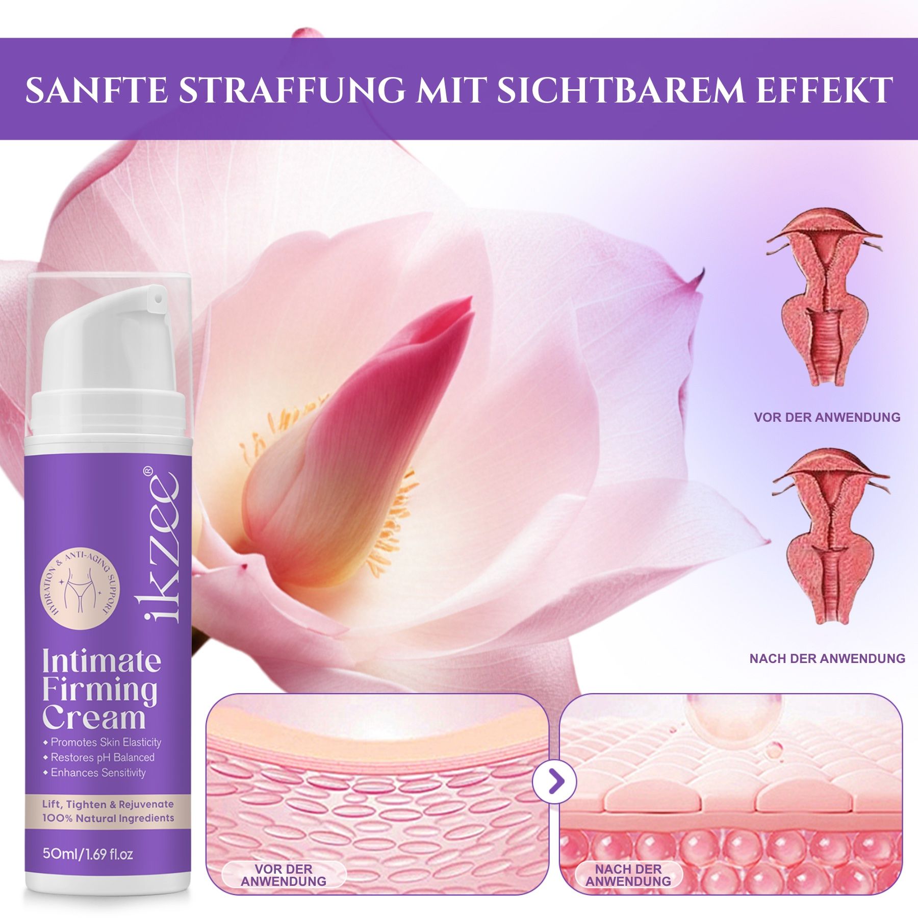 Flasche Intimcreme, lila-weiß, vor Blüte. Aufschrift: ikzee Intimate Firming Cream. 50ml/1.69 fl.oz. Diagramme: Vorher/Nachher.