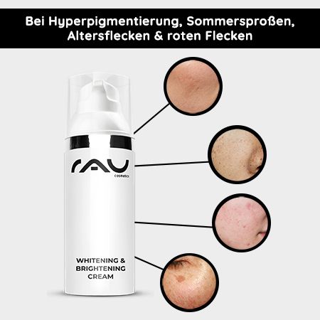 RAU Cosmetics Whitening & Brightening Cream - hautaufhellende Creme gegen Pigmentflecken, Rötungen