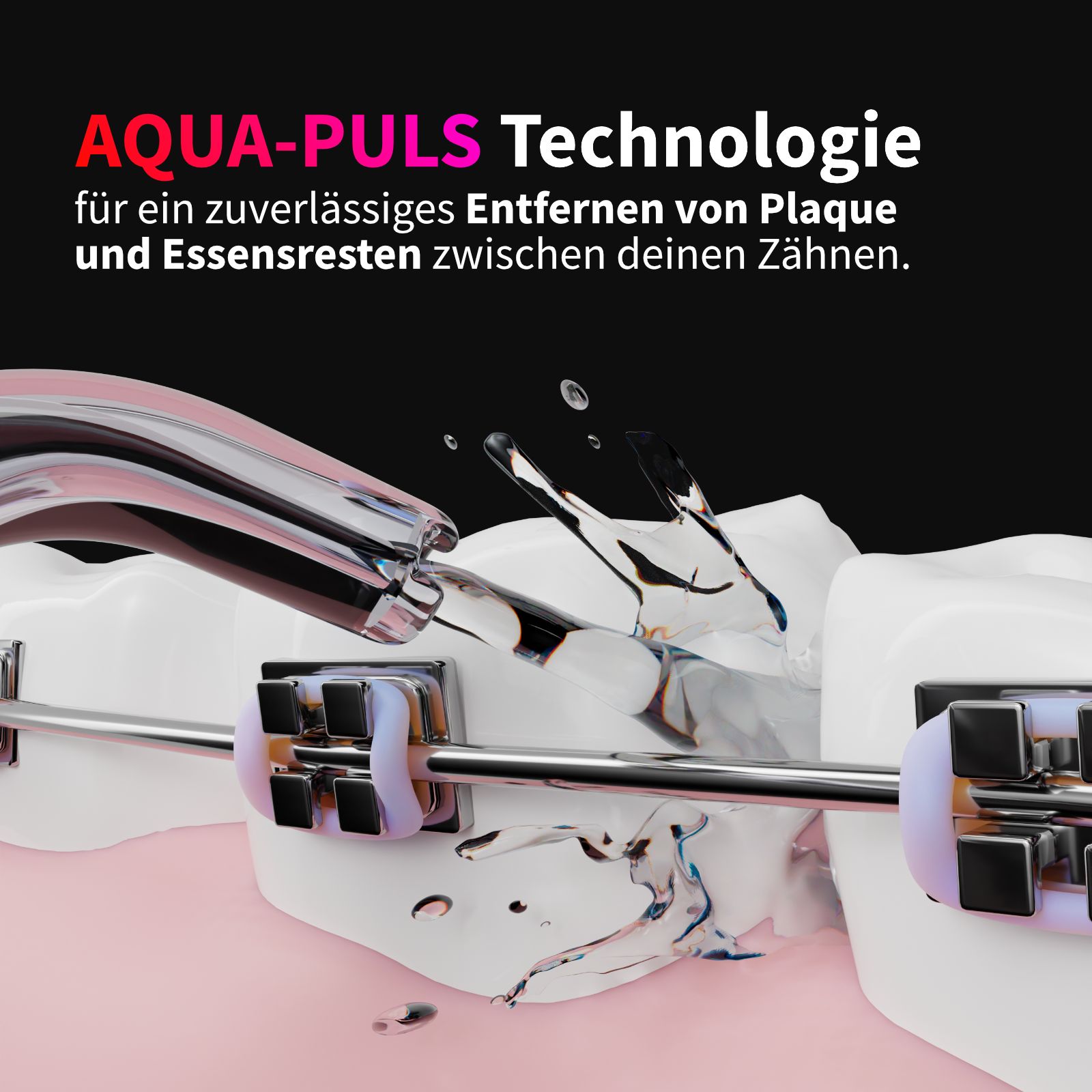 Zahnzwischenraumreinigung mit Wasserstrahl. Aqua-Puls Technologie. Zähne mit Zahnspange. Wasserstrahl zwischen Zähnen.