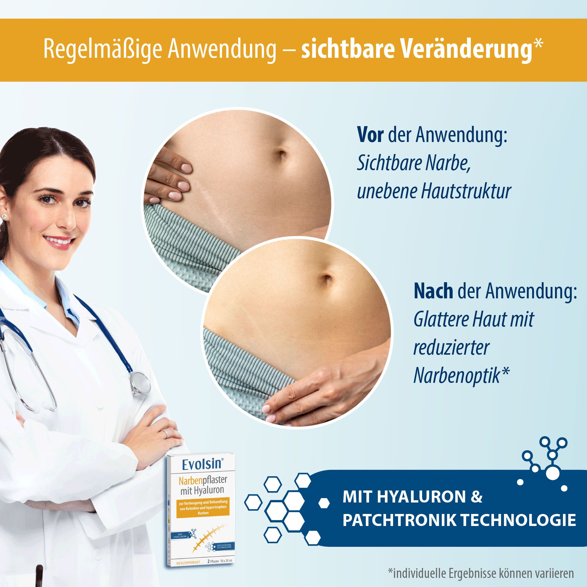 Evolsin Narbenpflaster mit Hyaluron