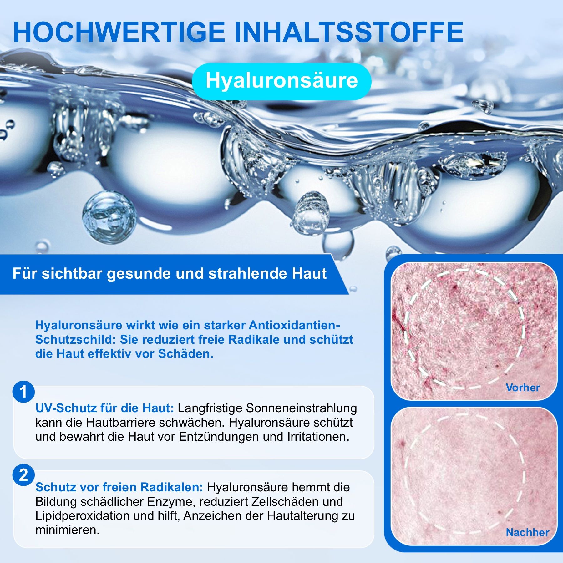 Diagramm mit Hyaluronsäure. Text: UV-Schutz, Schutz vor freien Radikalen. Blaue und rote Farbtöne.