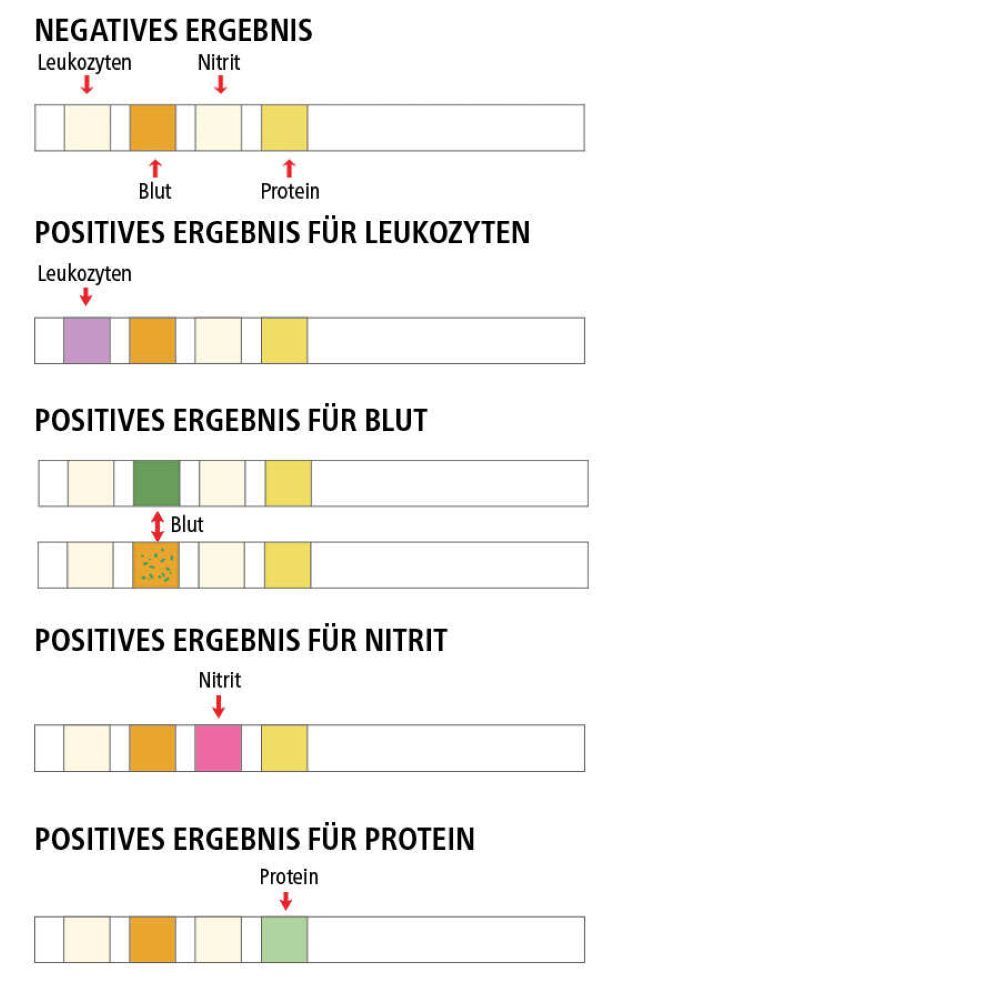 Ergebnis-Diagramm: Negative und positive Ergebnisse für Leukozyten, Blut, Nitrit und Protein.