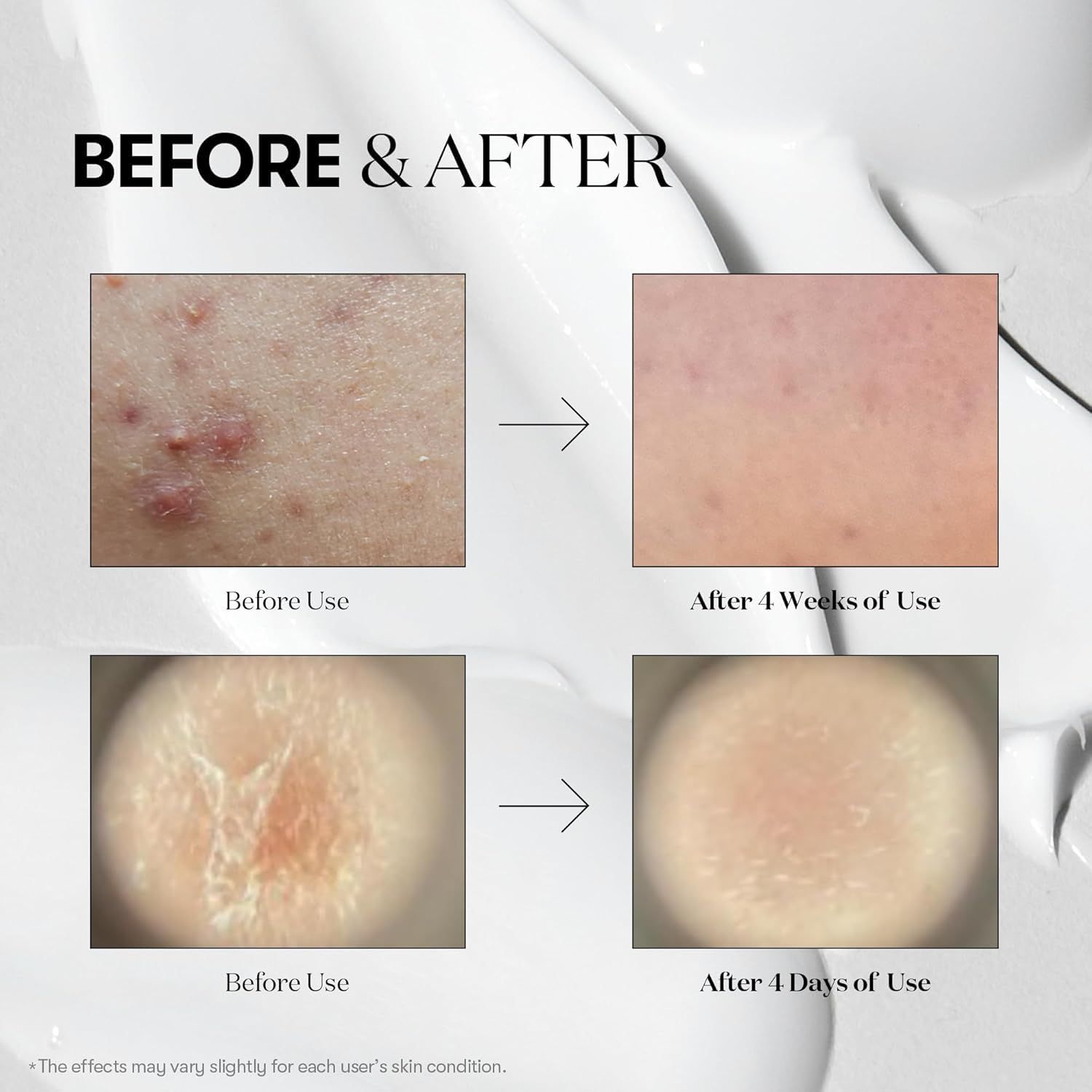 Vorher-Nachher-Bilder. Haut vor und nach Anwendung. Verbesserungen sichtbar. Text: BEFORE & AFTER.