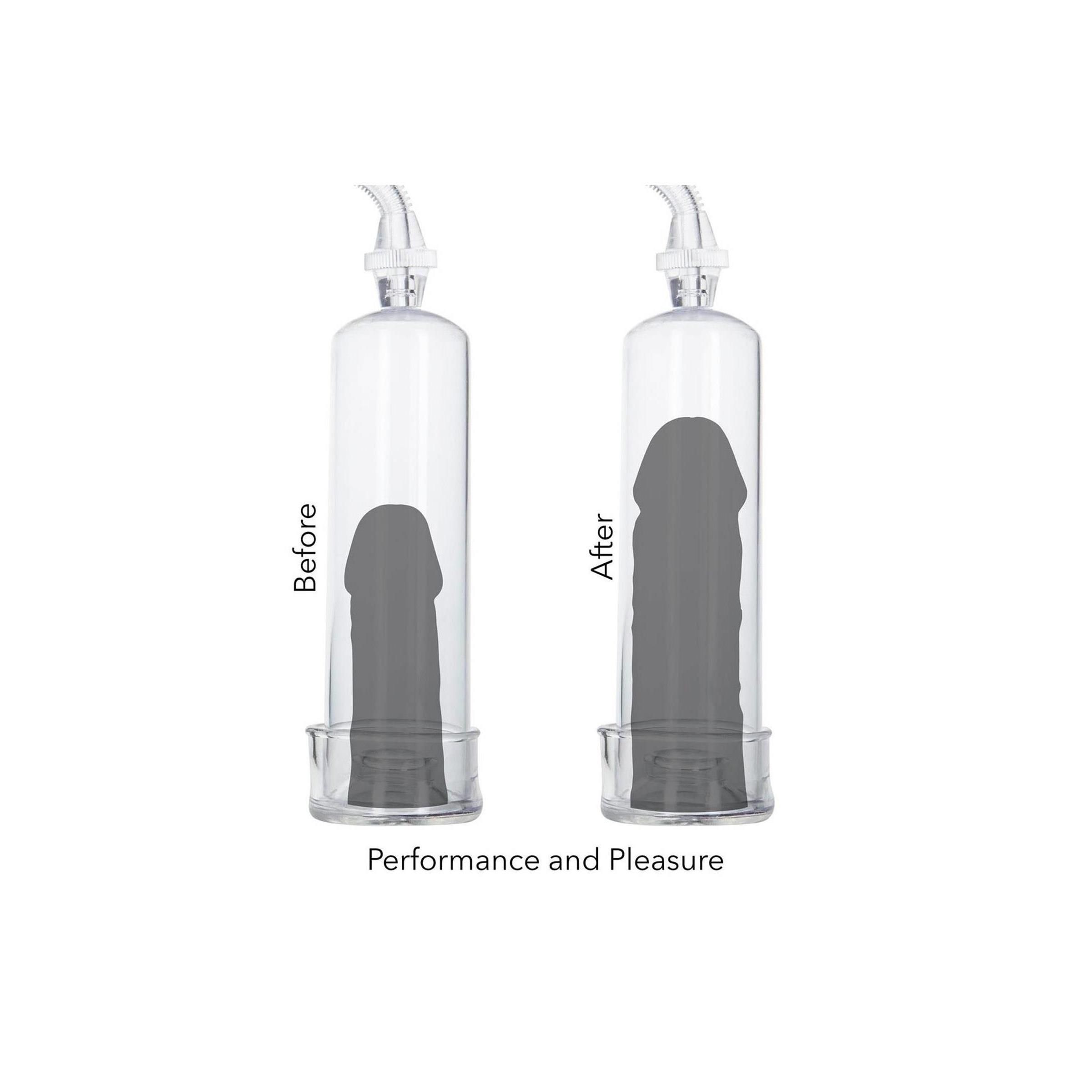 CalExotics - Erection Pump