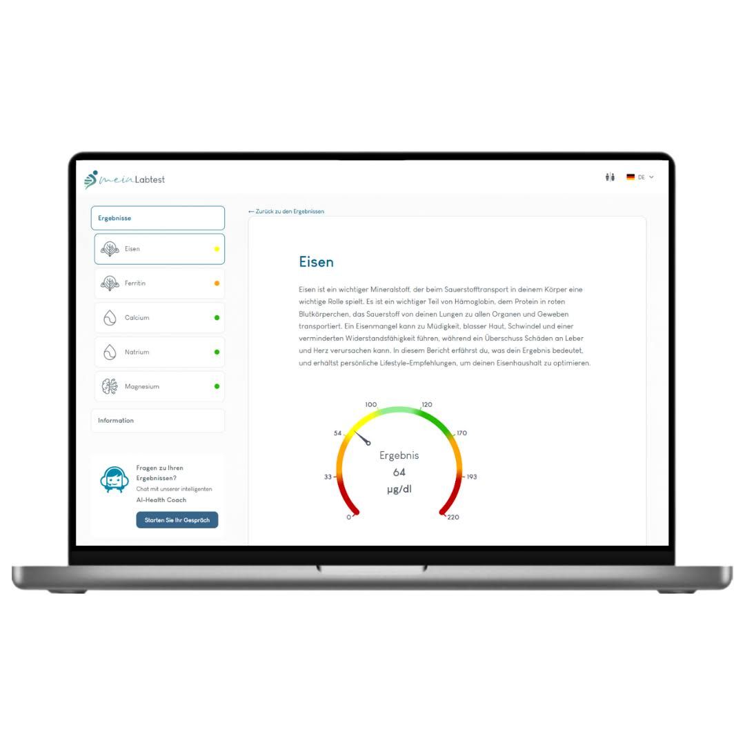 Laptop mit Testergebnissen. Ergebnisse für Eisen werden auf dem Bildschirm angezeigt, mit Diagramm und Text.