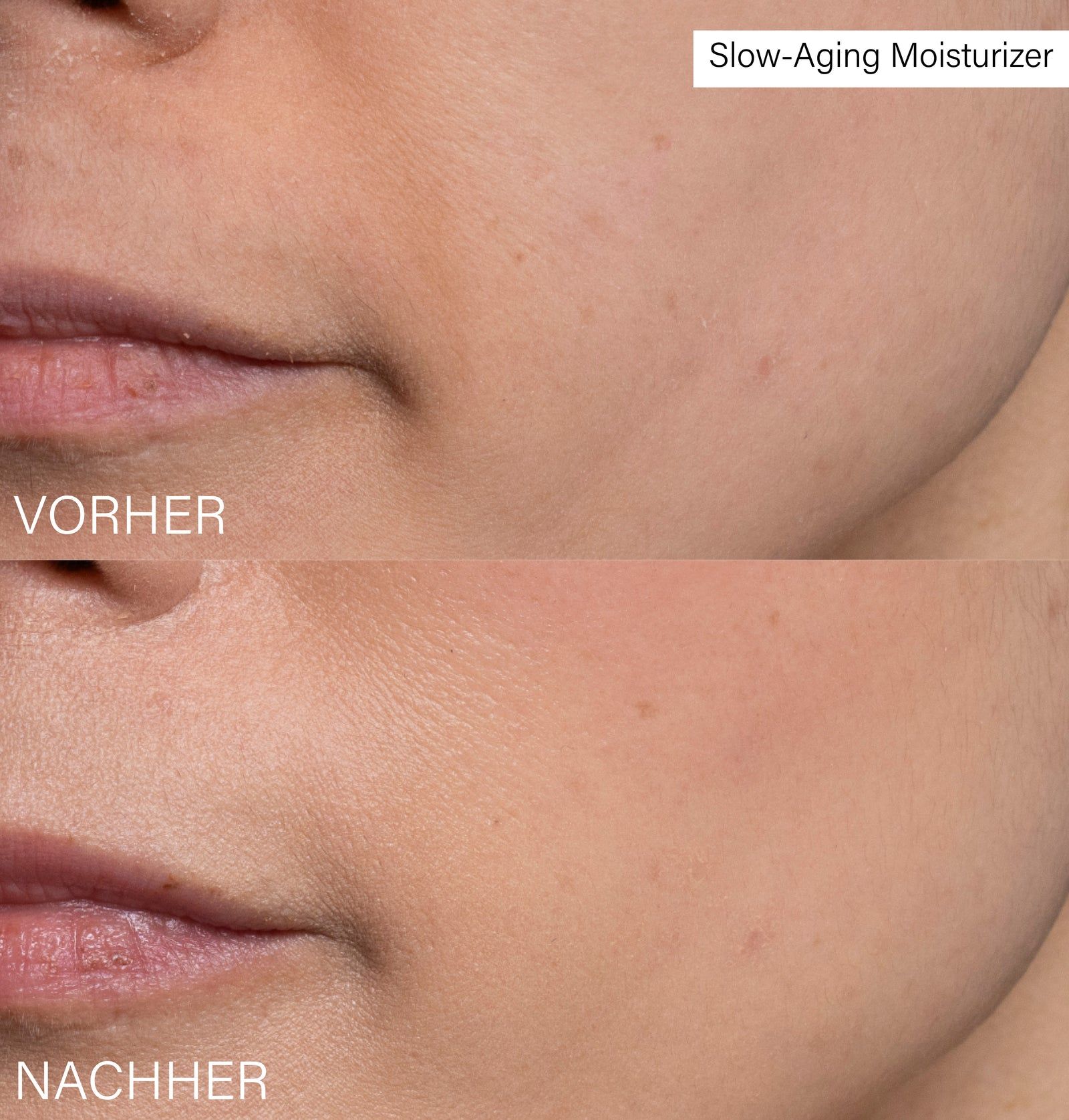 Nahaufnahme von Hautpartien vor und nach der Anwendung. Texturvergleich. Beschriftung: Vorher, Nachher.