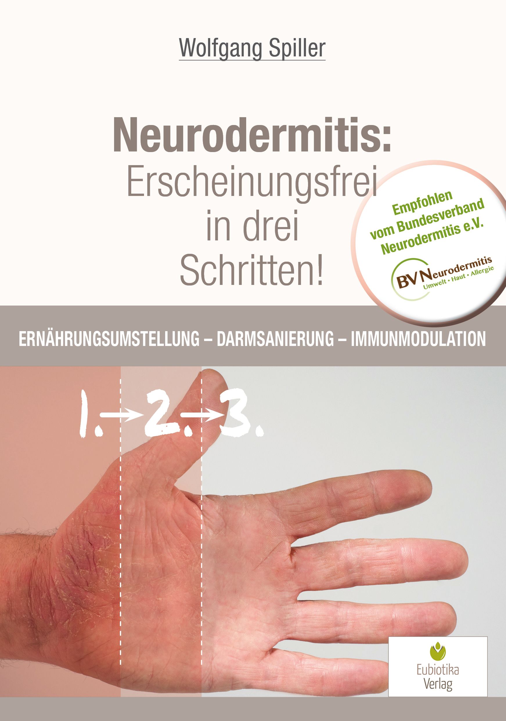 Neurodermitis: Erscheinungsfrei in drei Schritten!