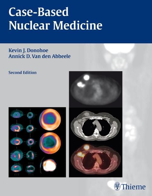 Buchcover mit Titel 'Case-Based Nuclear Medicine', Autorennamen und Abbildungen medizinischer Scans. Verlag Thieme.