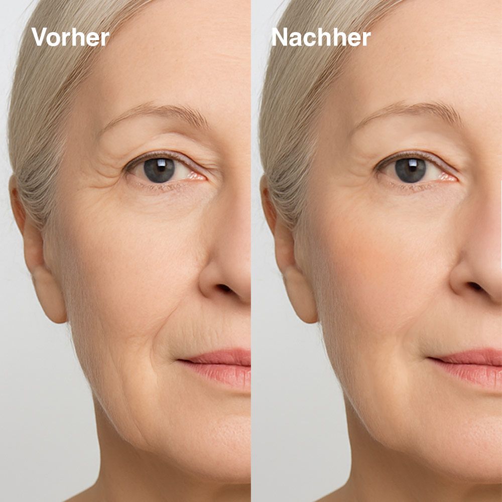 KU2 LED Rotlicht-Gesichtsmaske KU-RL12