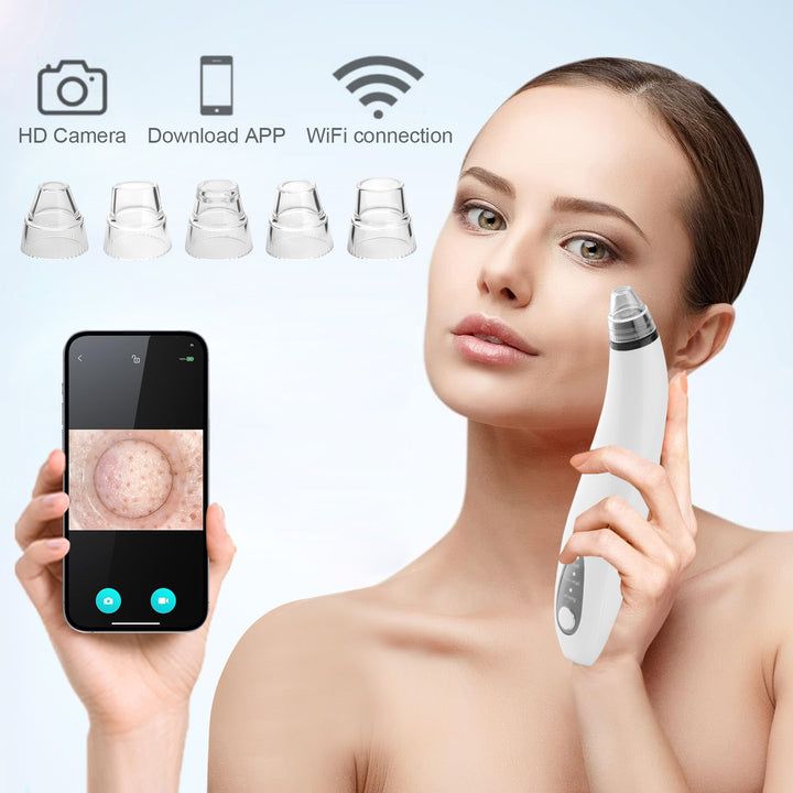 Mitesser-Staubsauger mit integrierter Kamera-PALOMA BEAUTIES