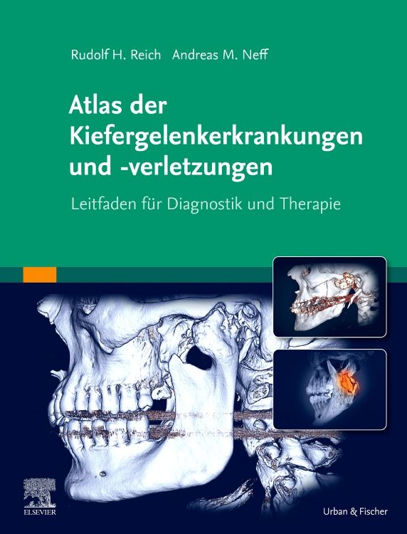Buchcover: Atlas der Kiefergelenkerkrankungen und -verletzungen. Autoren: Rudolf H. Reich, Andreas M. Neff. Verlag: Urban & Fischer. Abbildungen von Kiefergelenken.