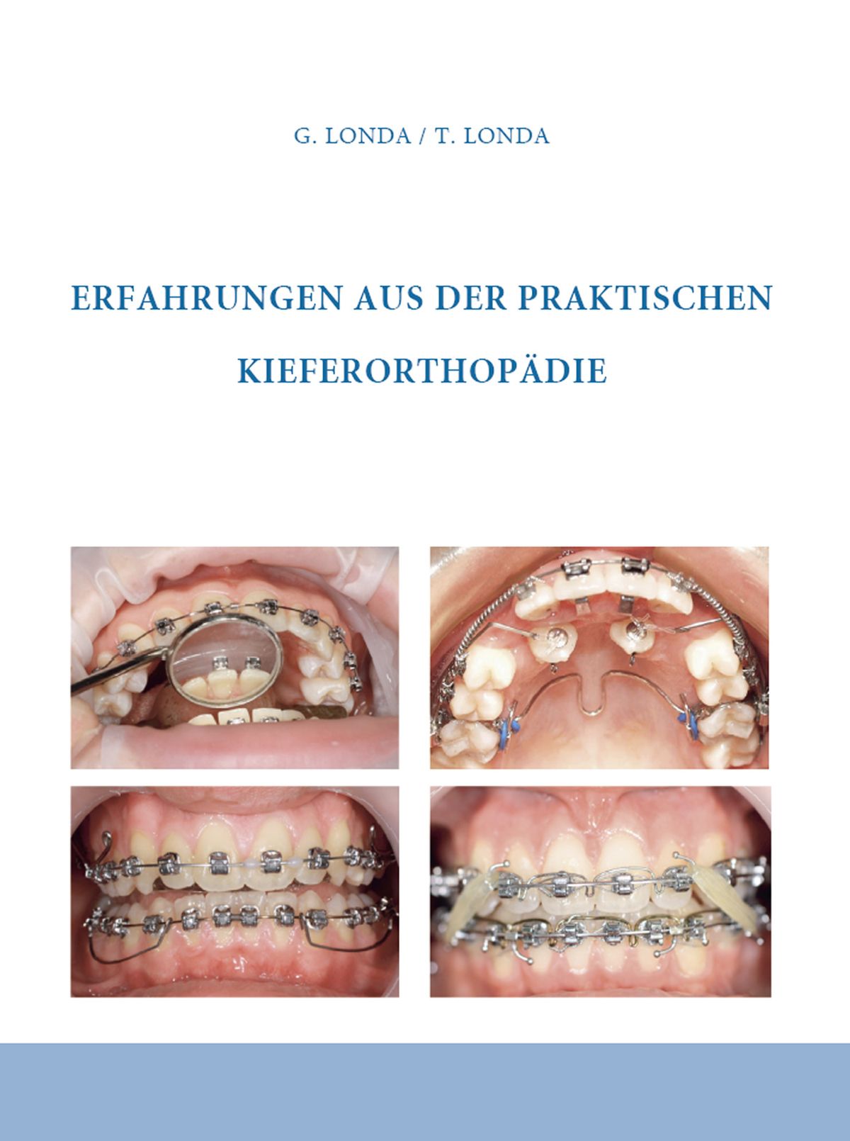 Erfahrungen aus der praktischen Kieferorthopädie