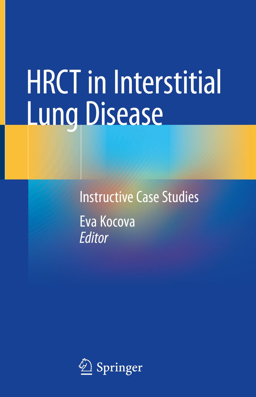 Hrct In Interstitial Lung Disease 1 St Shop Apotheke 4706