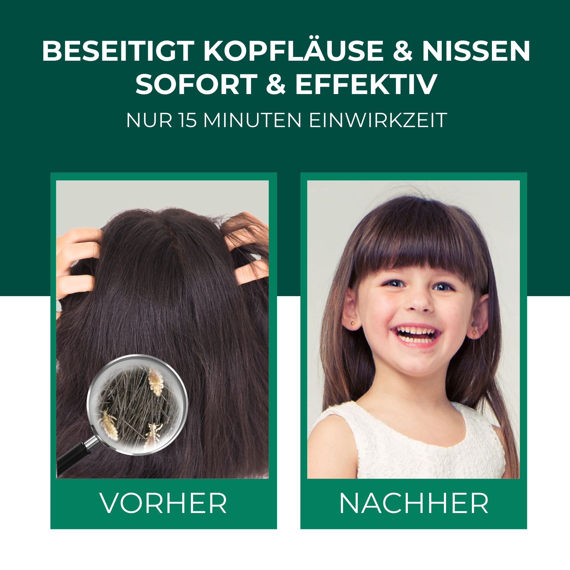 Vorher-Nachher-Vergleich: Haare mit Läusen (vorher) und ein lächelndes Kind (nachher). Text: Beseitigt Kopfläuse & Nissen sofort & effektiv.