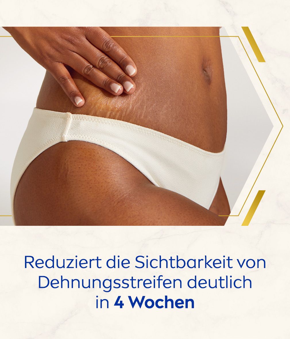 NIVEA Anti-Dehnungsstreifen + Pigmentflecken LUMINOUS630® Body Lotion 2 x 200ml
