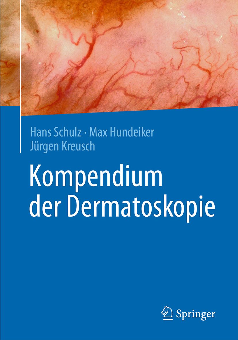 Buchcover mit Titel "Kompendium der Dermatoskopie". Autoren: Hans Schulz, Max Hundeiker, Jürgen Kreusch. Verlag Springer.