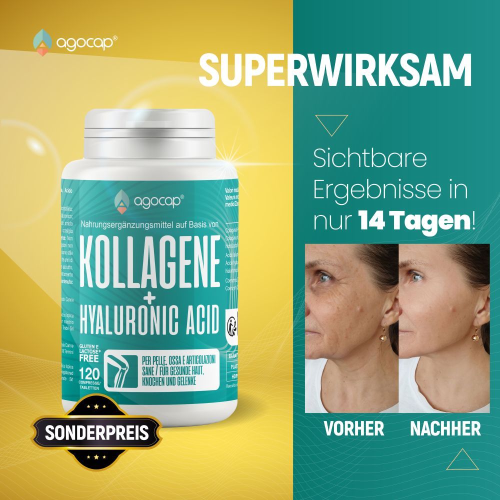 Vorher-Nachher-Gesichter. Text: SUPERWIRKSAM, Ergebnisse in 14 Tagen. Kollagene + Hyaluronsäure.
