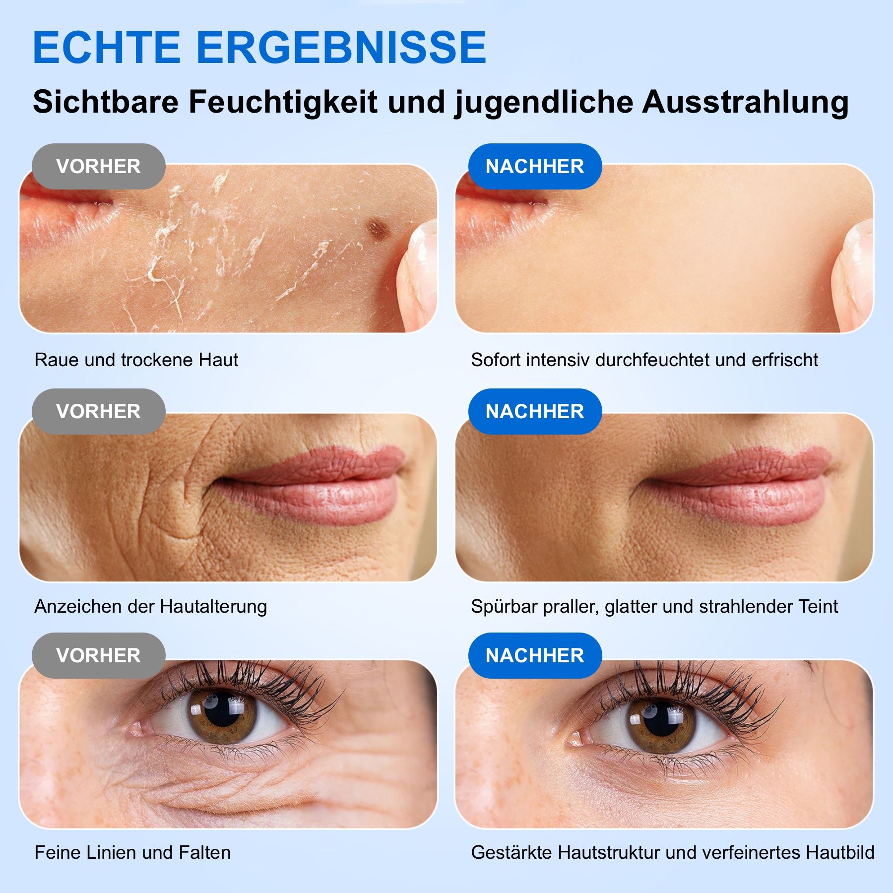 Vorher-Nachher-Vergleich. Text: Rauhe Haut, Falten, etc. Ergebnisse: glatte Haut, reduzierte Falten.