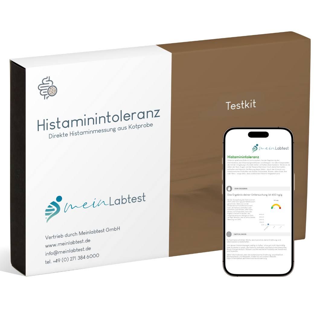 Box und Smartphone. Box: Weiß-braun, Aufschrift: Histaminintoleranz, Testkit. Logo: meinLabtest. Smartphone: Testergebnis-Anzeige.