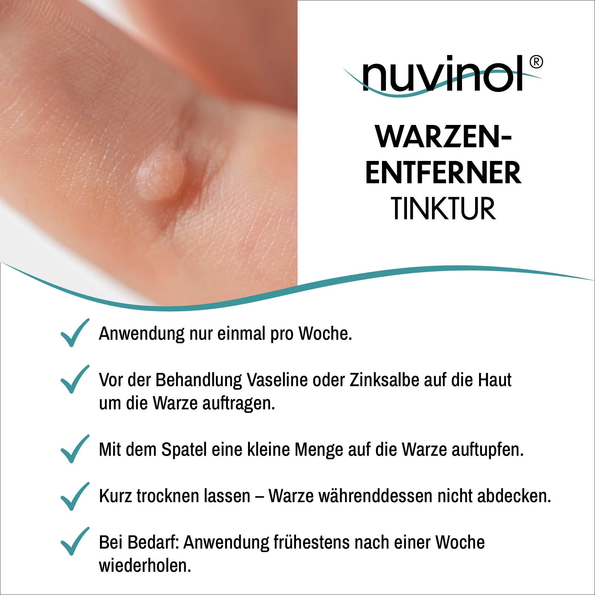 Nahaufnahme einer Hand mit Warze. Text: Warzenentferner Tinktur. Text: Anwendung nur einmal pro Woche. Mit Spatel auftupfen. Bei Bedarf wiederholen.