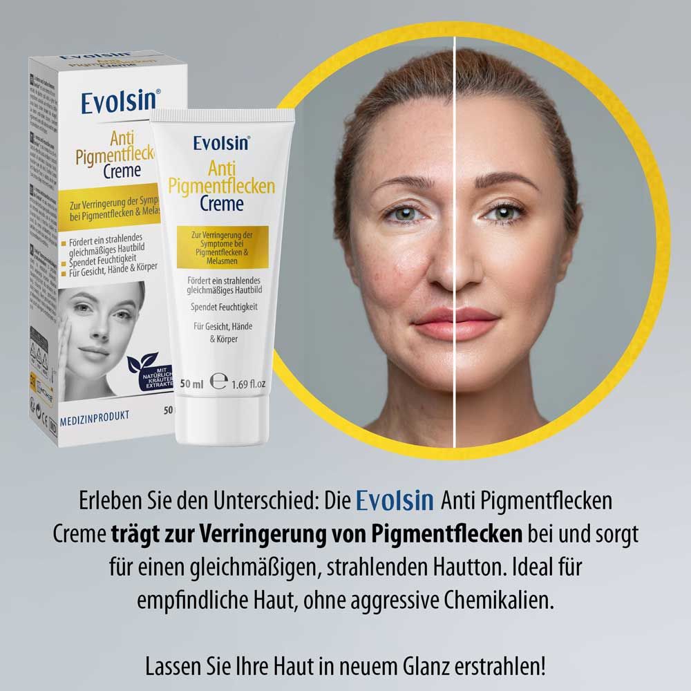 Vergleich Vorher/Nachher. Text: EVOLSIN® Anti Pigmentflecken Creme. Für gleichmäßigen Hautton. Ohne Chemikalien.