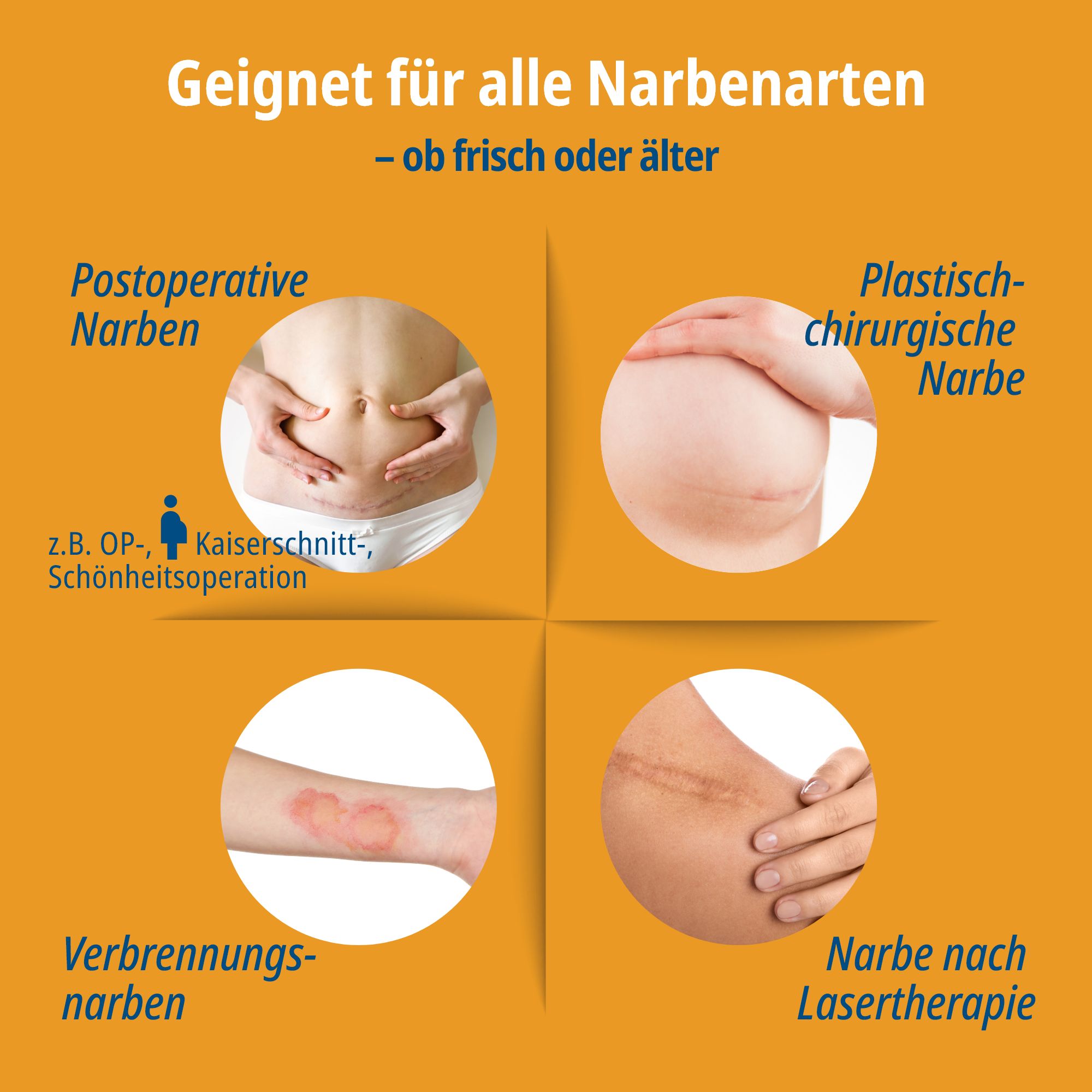 Evolsin® Narben Intensiv-Kur: Narbengel + Narbenpflaster - Reduziert die Sichtbarkeit von Narben und