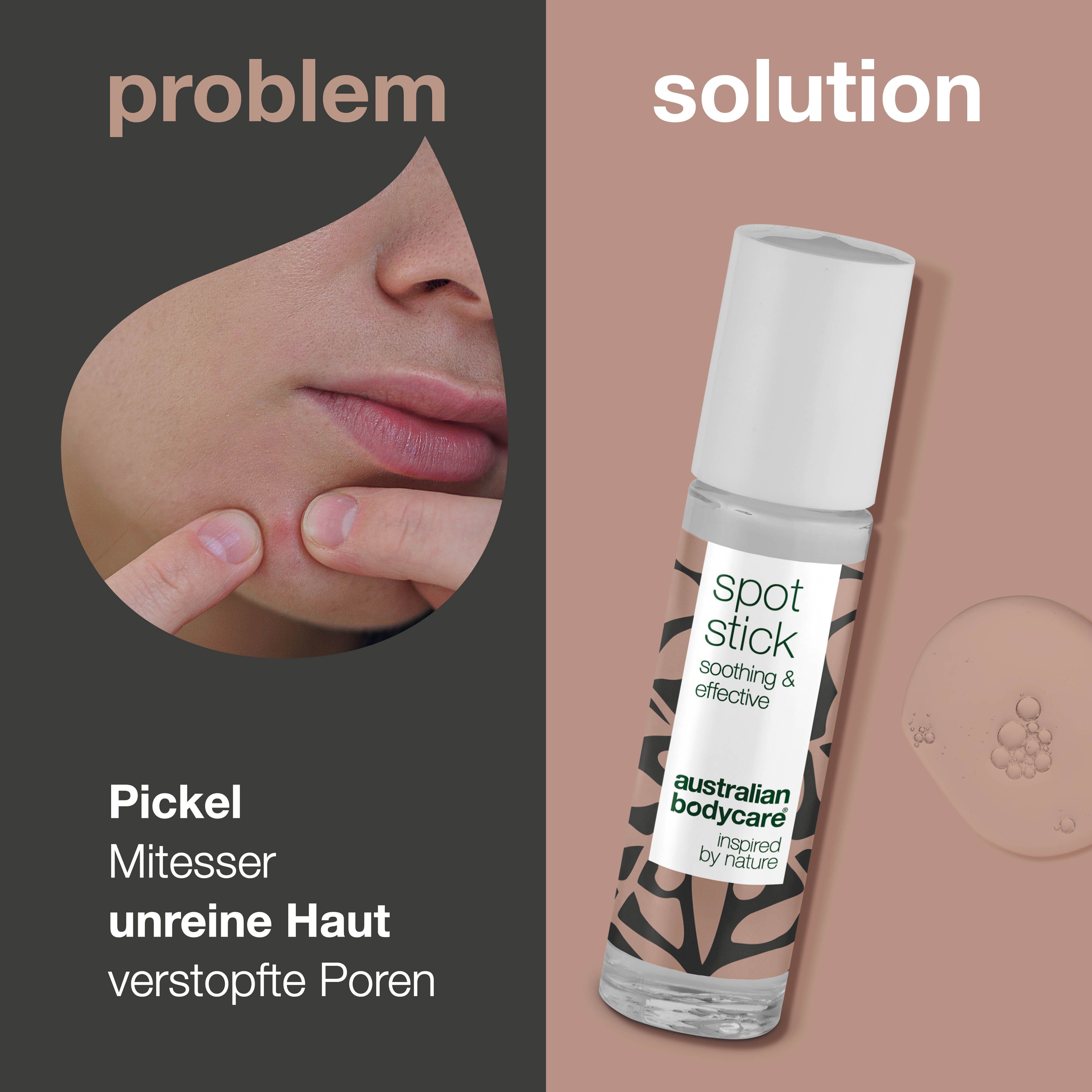 Produkt- und Problem-Lösung-Vergleich. Spot Stick, Australian Bodycare. Text: Pickel, Mitesser, unreine Haut.
