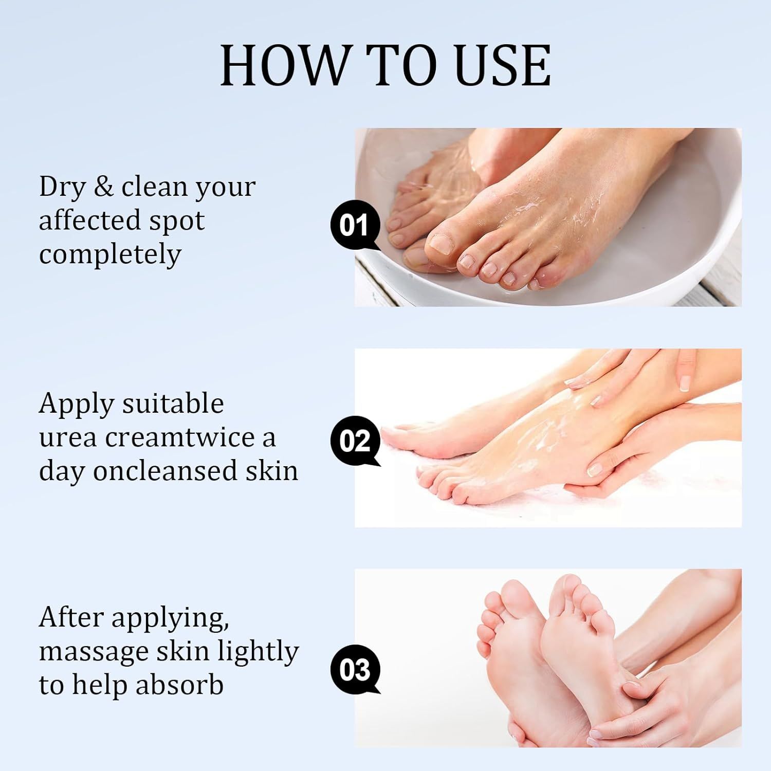 AONAT Urea Creme 40 Prozent