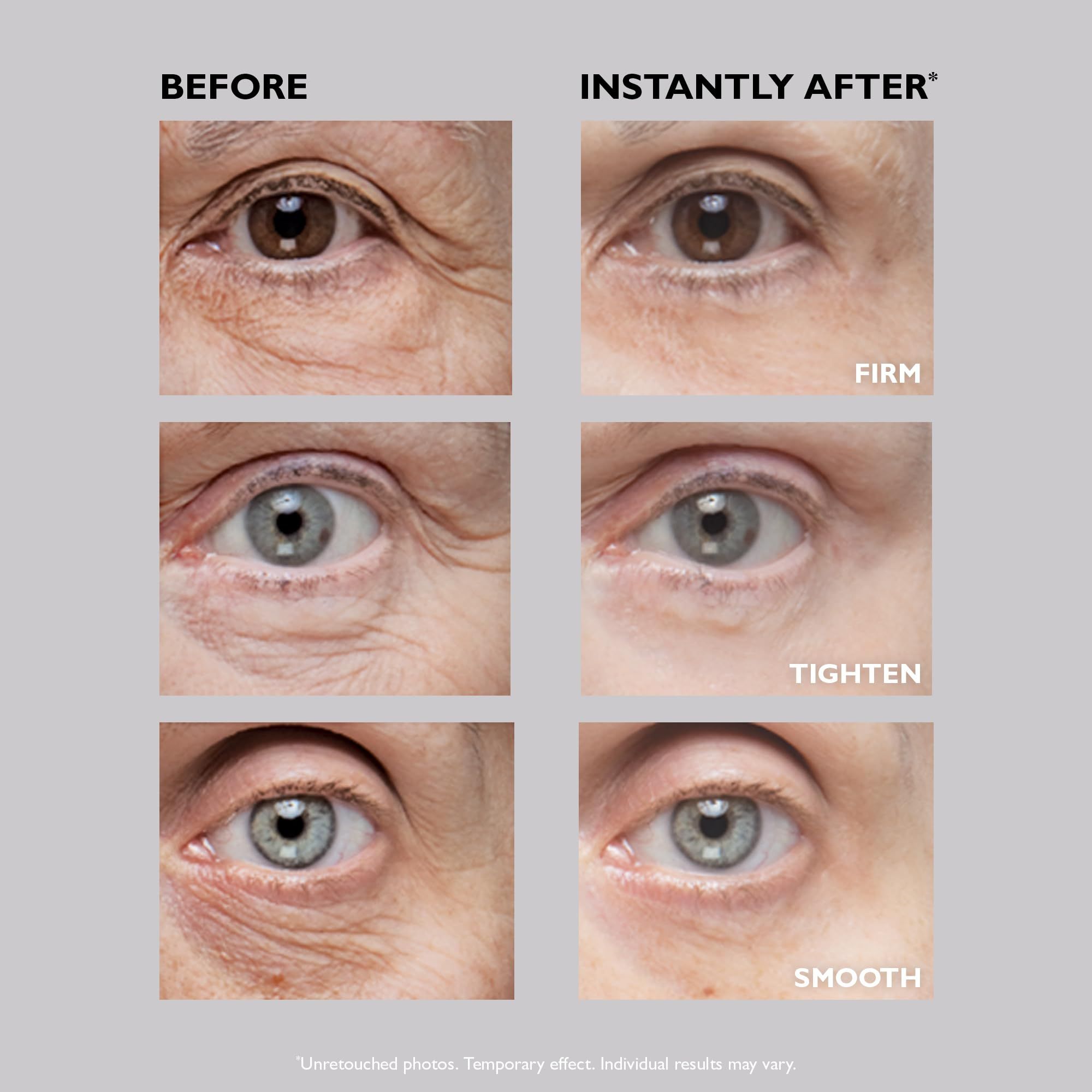 Vergleichsbild: Vorher und nachher Anwendung von Peter Thomas Roth Instant Firmx Eye.