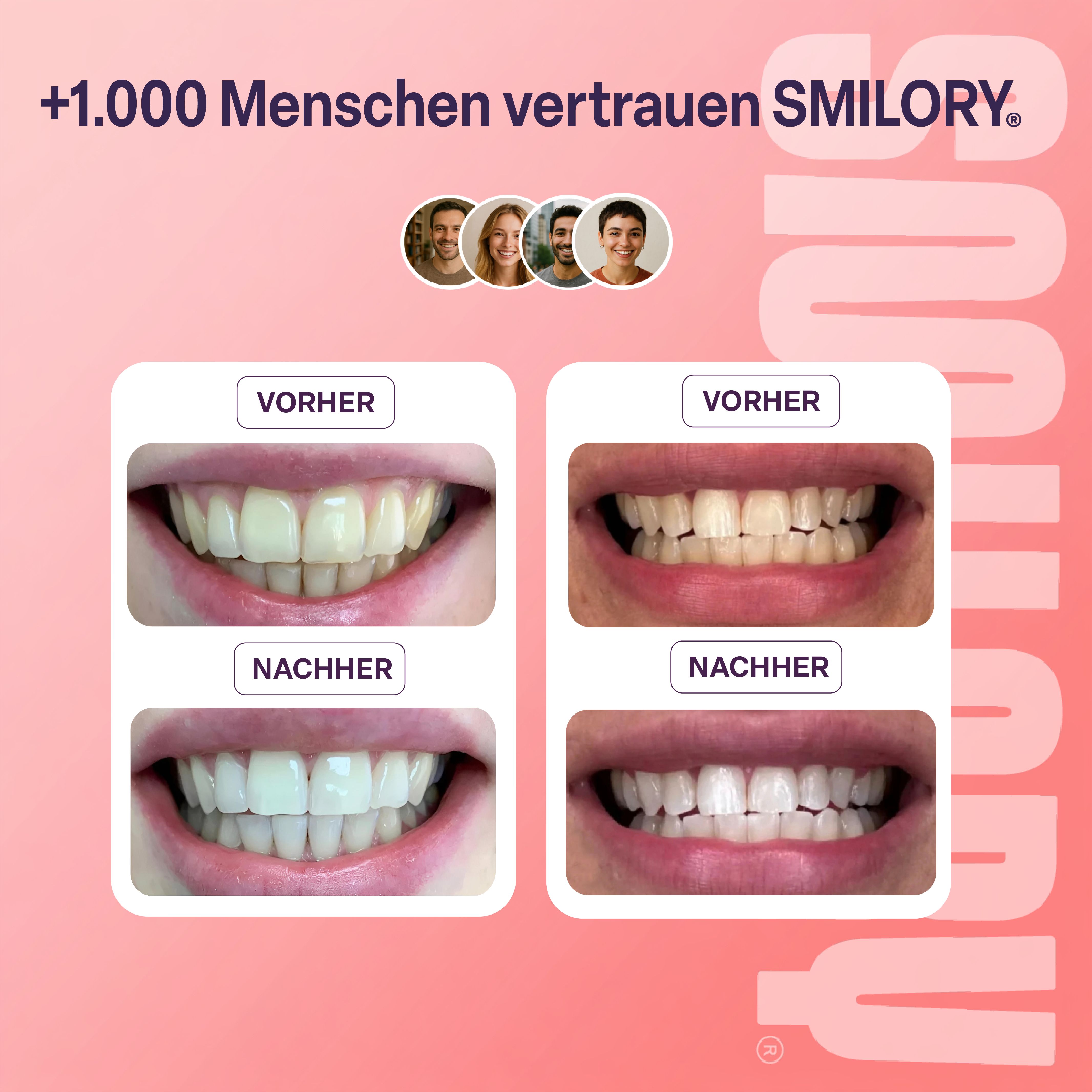 Vorher-Nachher-Vergleich von Zähnen. Vier Paare von Zähnen, die vor und nach der Anwendung gezeigt werden.
