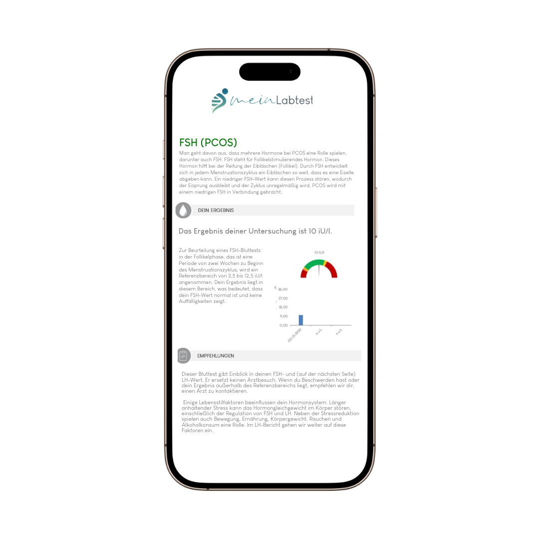 Smartphone mit Testergebnissen. Anzeige von FSH-Werten und Diagrammen.