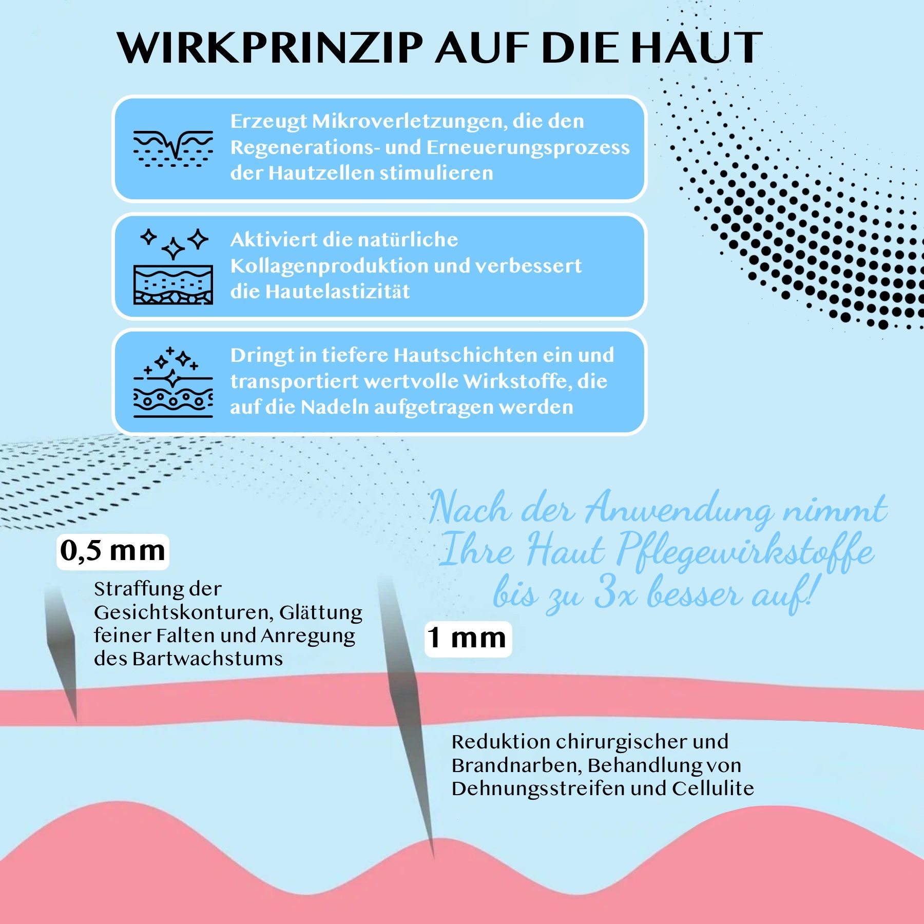Diagramm, das die Wirkung des Derma-Rollers auf die Haut zeigt. Enthält Informationen zu 0,5 mm und 1 mm.
