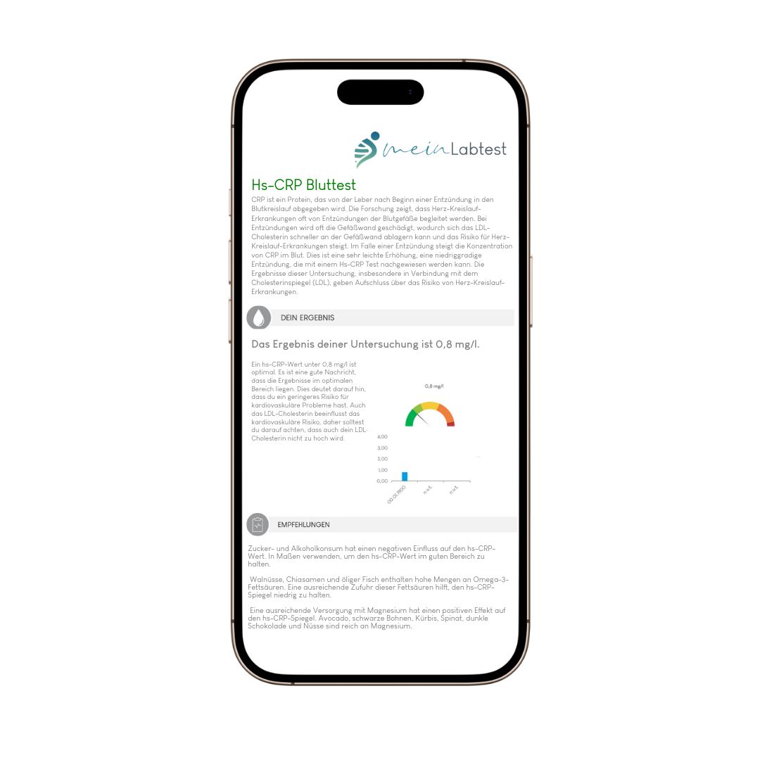 Smartphone mit hs-CRP-Bluttest-Ergebnisanzeige. Marke: meinLabtest.